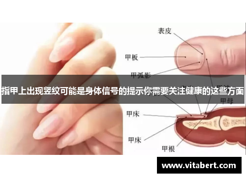 指甲上出现竖纹可能是身体信号的提示你需要关注健康的这些方面